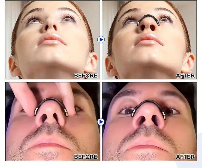 شرائط الأنف المغناطيسية