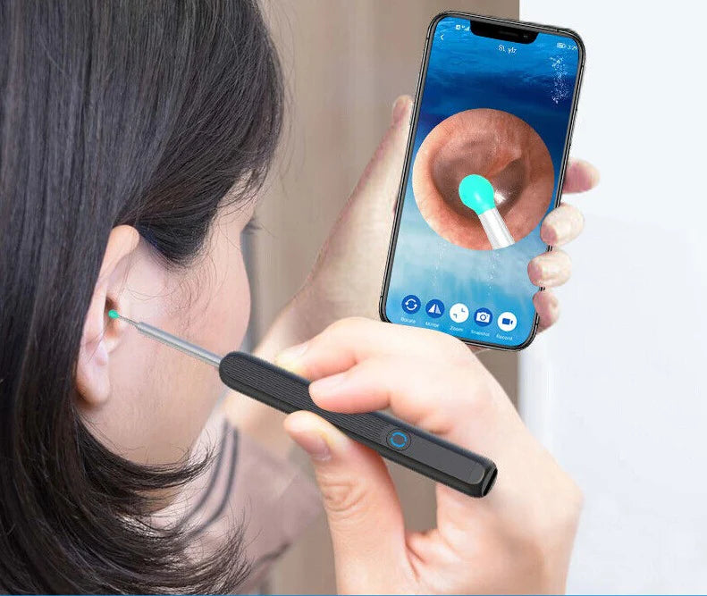 -ProCare  -جهاز تنضيف أذن طبي